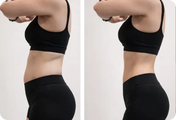 Antes e depois de usar o App Befit