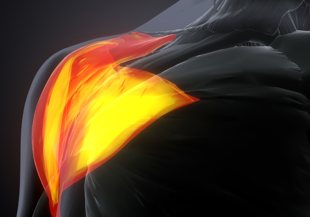 Deltoides Posterior: Los Mejores Ejercicios y Cómo Entrenarlo para un Desarrollo Completo